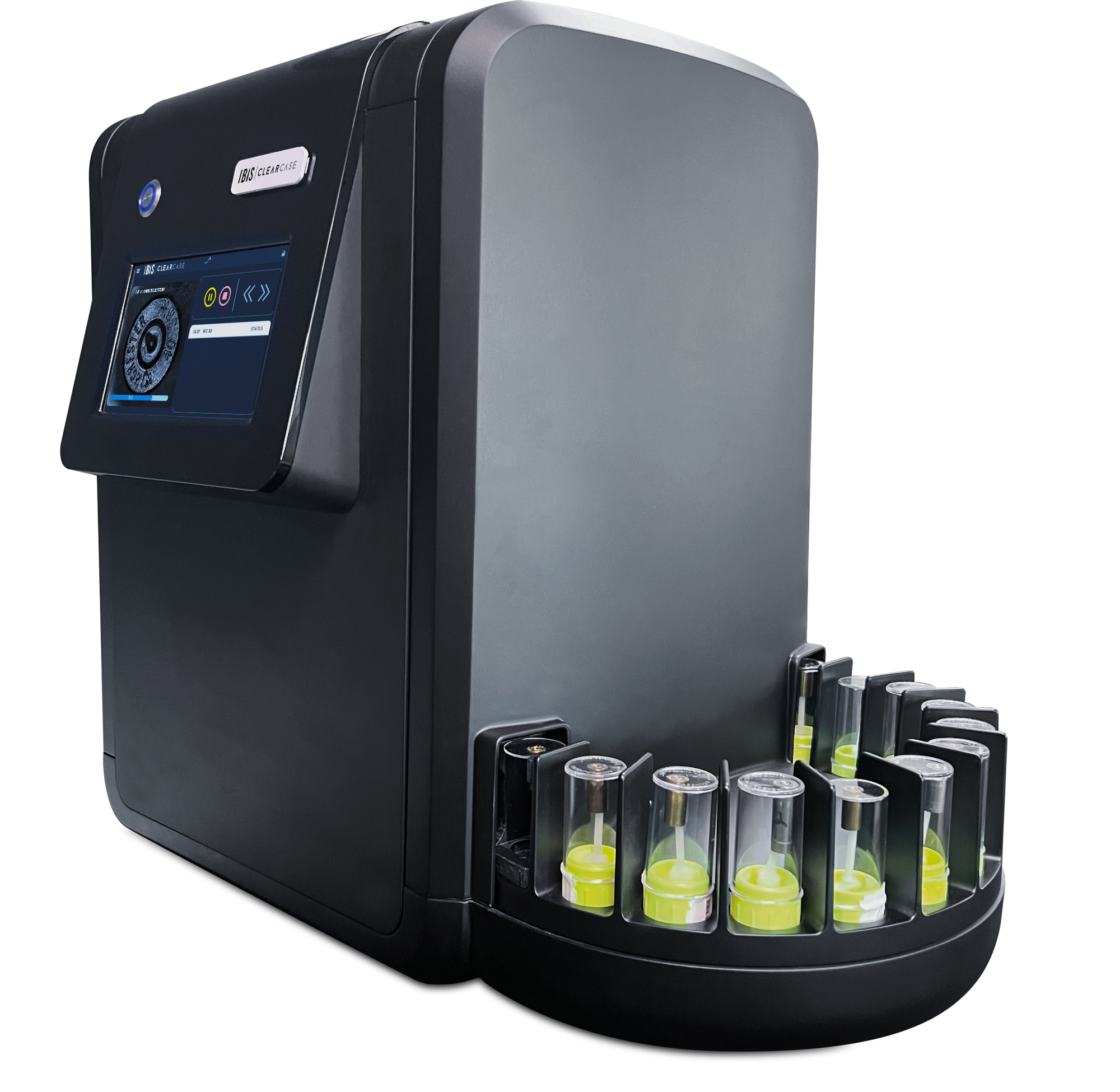 The ClearCase triage machine.
